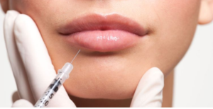 لیست بهترین مراکز تزریق ژل در شیراز + هزینه تزریق ژل 1402