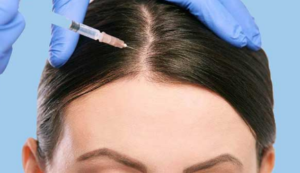 لیست بهترین مراکز مزوتراپی مو در شیراز + هزینه مزوتراپی مو 1402