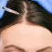 لیست بهترین مراکز مزوتراپی مو در شیراز + هزینه مزوتراپی مو 1402
