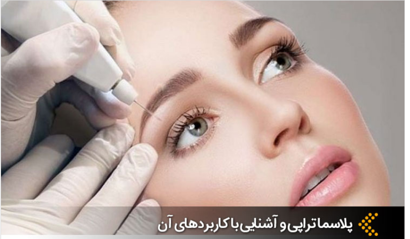 لیست بهترین مراکز پلاسما تراپی در شیراز + هزینه پلاسما تراپی