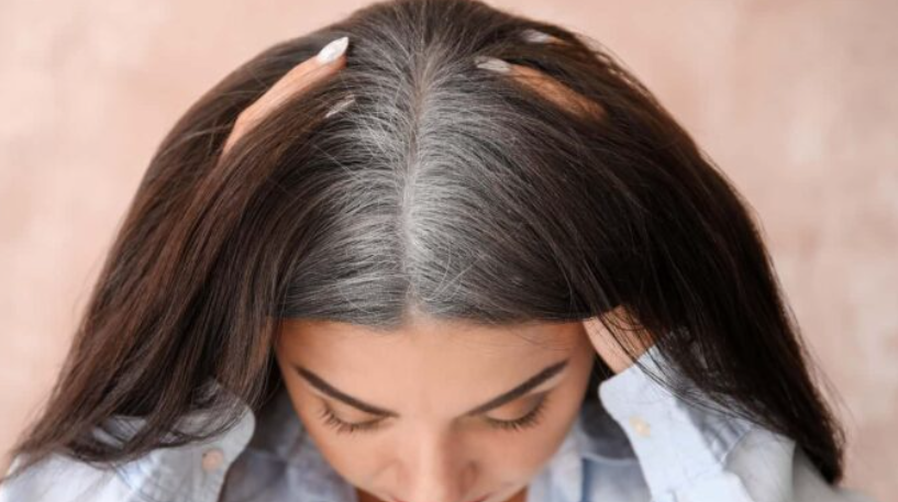 لیست بهترین مراکز رفع سفیدی مو در شیراز + هزینه رفع سفیدی مو