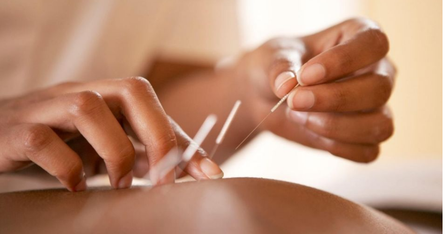 لیست بهترین مراکز طب سوزنی در فرمانیه + هزینه طب سوزنی
