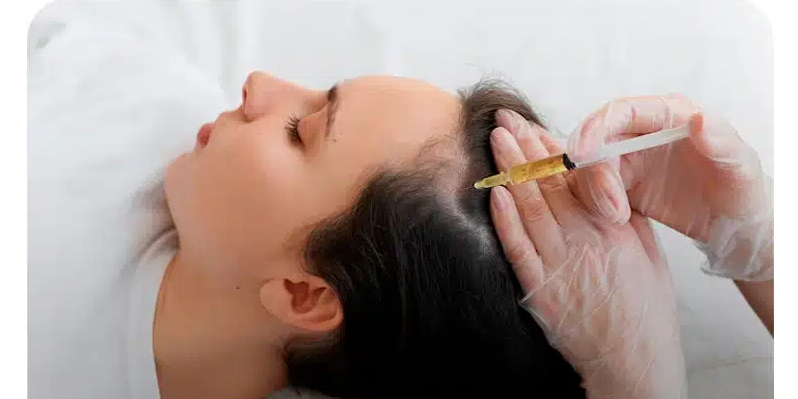 لیست بهترین مراکز مزوتراپی مو در فرمانیه + هزینه مزوتراپی مو