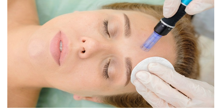 لیست بهترین مراکز میکرونیدلینگ در فرمانیه + هزینه میکرونیدلینگ