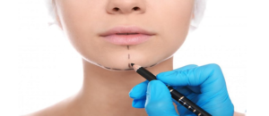 لیست بهترین مراکز جراحی چانه در فرمانیه + هزینه جراحی چانه 1402
