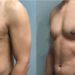 لیست بهترین مراکز عمل ژنیکوماستی در فرمانیه + هزینه عمل ژنیکوماستی 1402