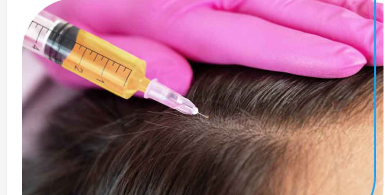 لیست بهترین مراکز مزوتراپی مو در کازرون + هزینه مزوتراپی مو
