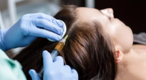 لیست بهترین مراکز مزوتراپی مو در آباده + هزینه مزوتراپی مو 1402