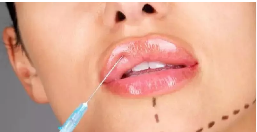 لیست بهترین مراکز تزریق ژل در کازرون + هزینه تزریق ژل