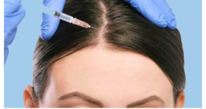 لیست بهترین مراکز مزوتراپی مو در مرودشت + هزینه مزوتراپی مو 1402