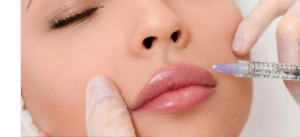 لیست بهترین مراکز تزریق ژل در مرودشت + هزینه تزریق ژل 1402