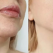 لیست بهترین مراکز کانتورینگ صورت در مرودشت + هزینه کانتورینگ صورت 1403