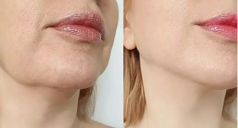 لیست بهترین مراکز کانتورینگ صورت در مرودشت + هزینه کانتورینگ صورت
