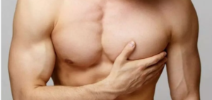 لیست بهترین مراکز عمل ژنیکوماستی در لار + هزینه عمل ژنیکوماستی 1403