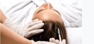لیست بهترین مراکز مزوتراپی مو در جهرم + هزینه مزوتراپی مو 1403