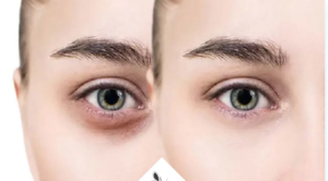 لیست بهترین مراکز کربوکسی تراپی در داراب + هزینه کربوکسی تراپی 1403