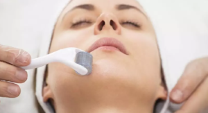 لیست بهترین مراکز میکرونیدلینگ در داراب + هزینه میکرونیدلینگ 1403