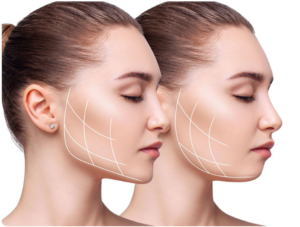 لیست بهترین مراکز بوکال فت در داراب + هزینه بوکال فت 1403