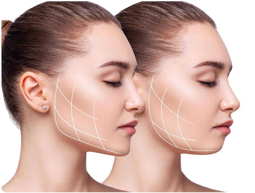 لیست بهترین مراکز بوکال فت در داراب + هزینه بوکال فت