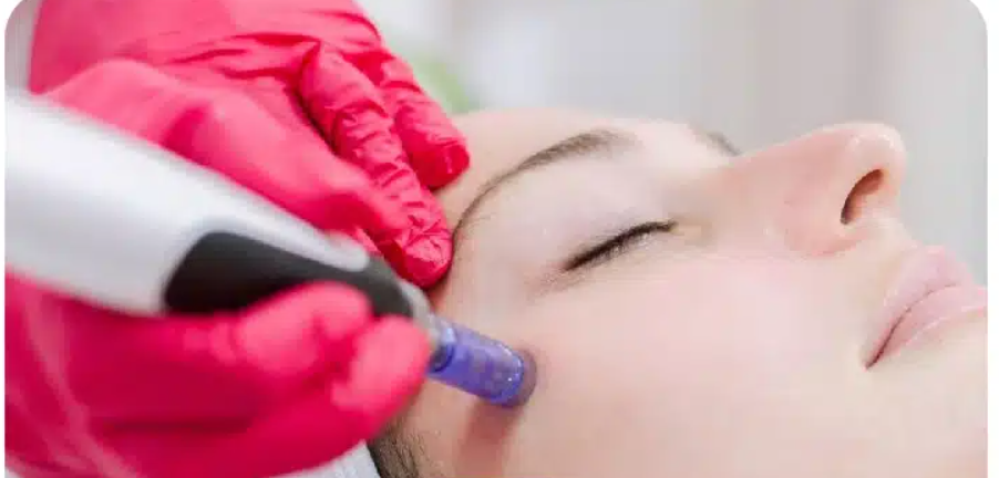لیست بهترین مراکز میکرونیدلینگ در اقلید + هزینه میکرونیدلینگ