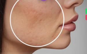 لیست بهترین مراکز سابسیژن در اقلید + هزینه سابسیژن 1403