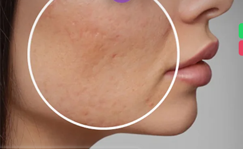 لیست بهترین مراکز سابسیژن در اقلید + هزینه سابسیژن
