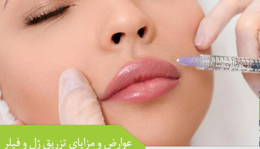 لیست بهترین مراکز تزریق ژل در نی ریز + هزینه تزریق ژل