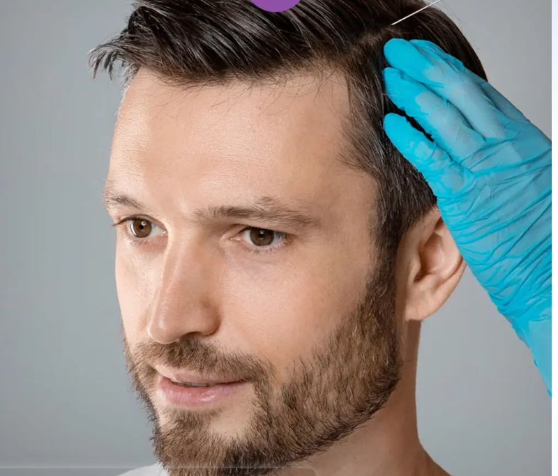 لیست بهترین مراکز مزوتراپی مو در اقلید + هزینه مزوتراپی مو