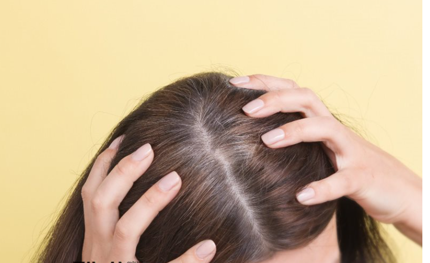 لیست بهترین مراکز رفع سفیدی مو در اقلید + هزینه رفع سفیدی مو