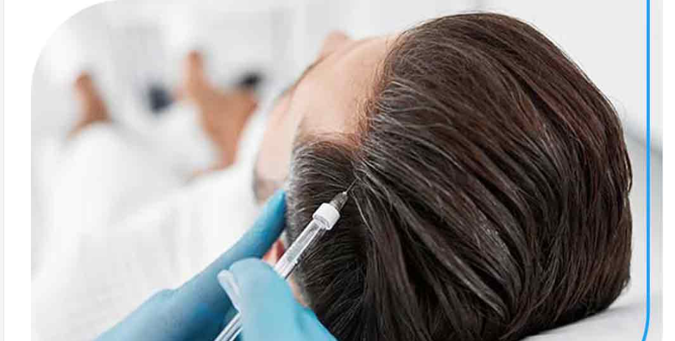 لیست بهترین مراکز مزوتراپی مو در استهبان + هزینه مزوتراپی مو
