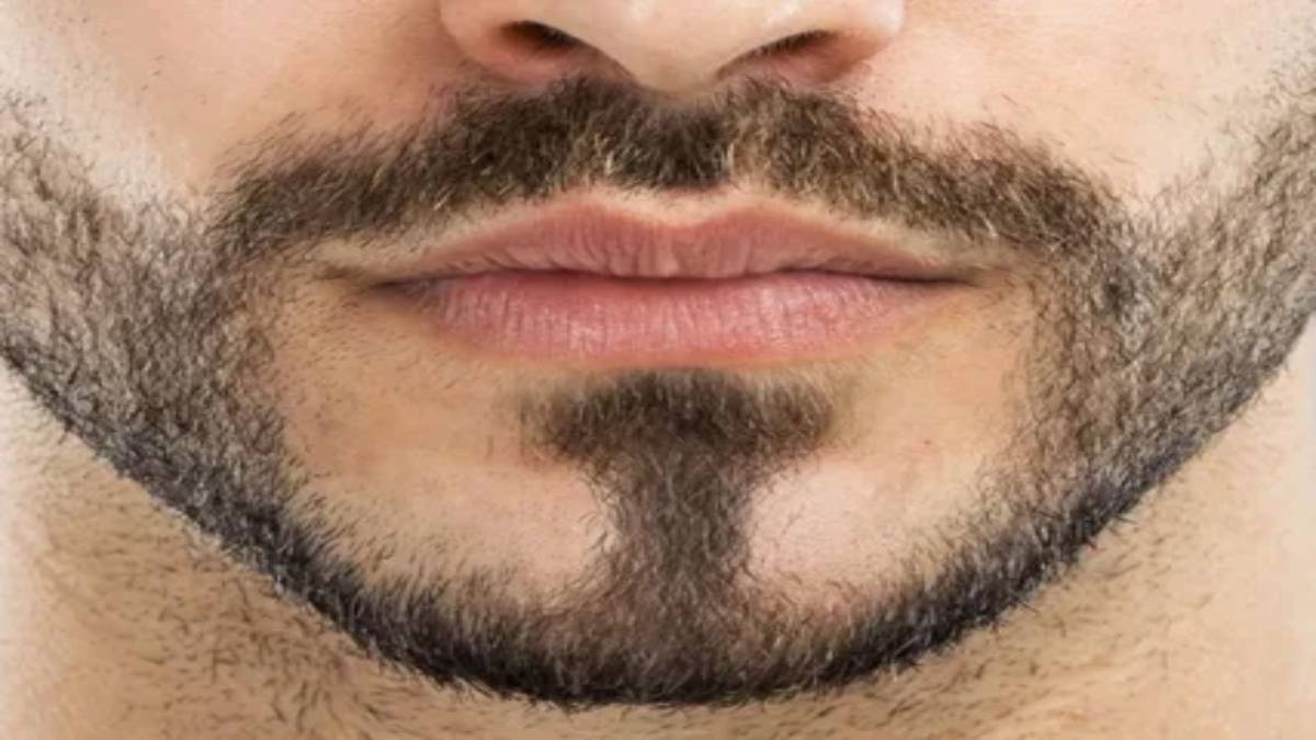 لیست بهترین مراکز کاشت ریش در اندرزگو + هزینه کاشت ریش