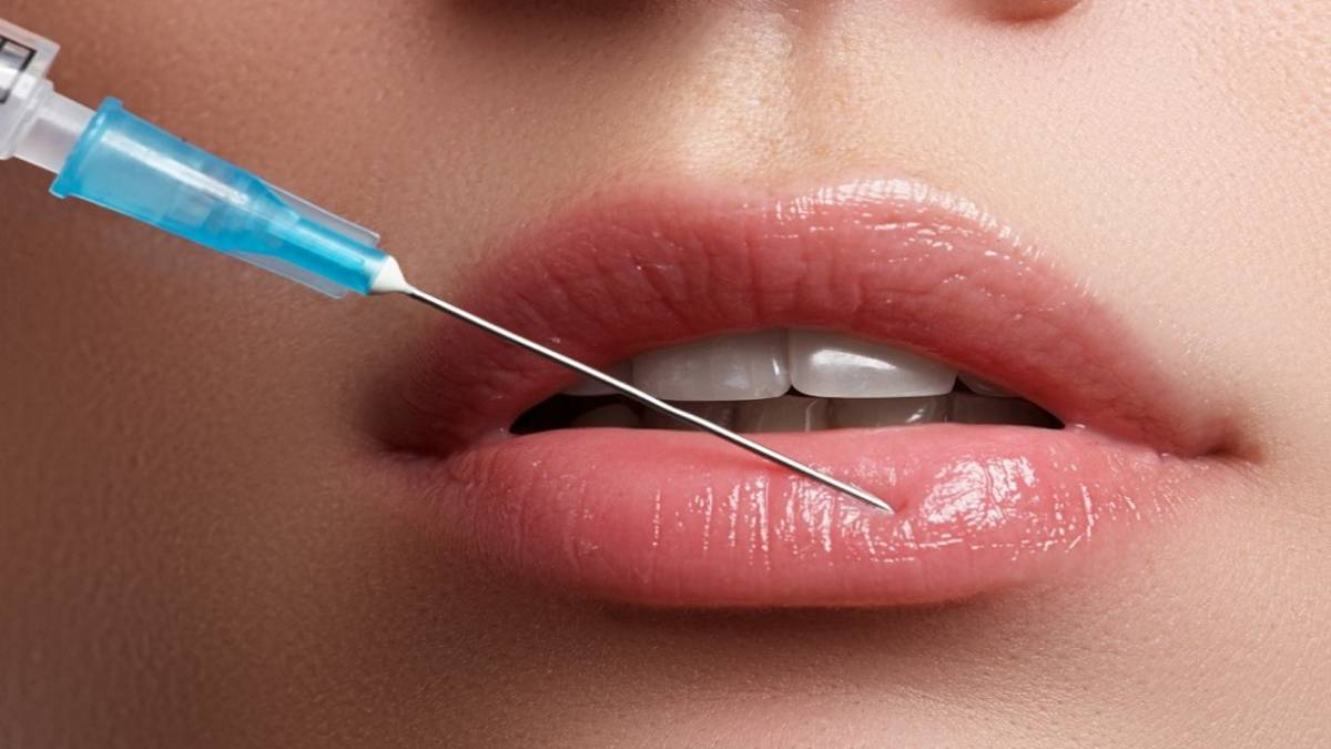 لیست بهترین مراکز تزریق فیلر در تجریش + هزینه تزریق فیلر