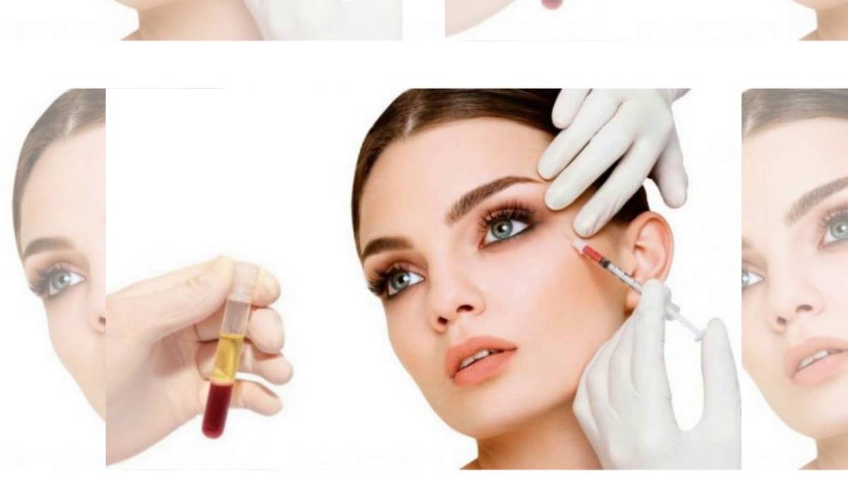 لیست بهترین مراکز تزریق پی آر پی در تجریش + هزینه تزریق پی آر پی
