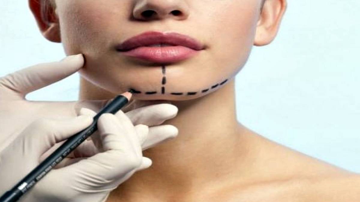 لیست بهترین مراکز جراحی چانه در اندرزگو + هزینه جراحی چانه