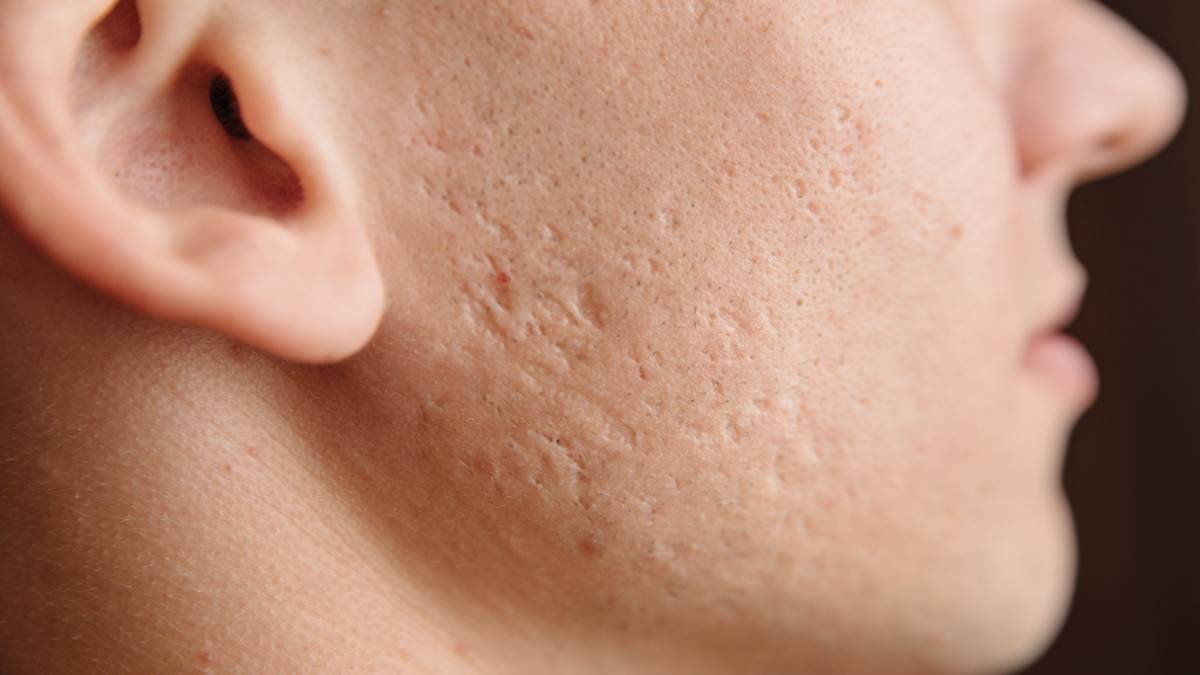 لیست بهترین مراکز سابسیژن در تجریش + هزینه سابسیژن
