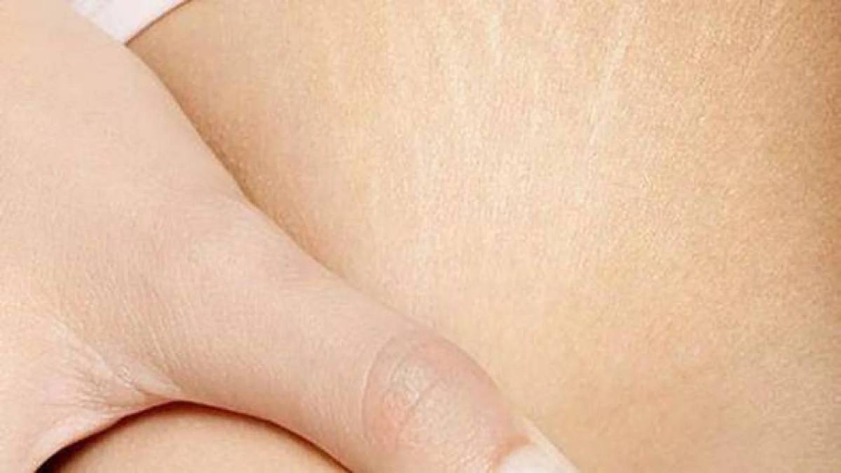 لیست بهترین مراکز درمان ترک پوستی در تجریش + هزینه درمان ترک پوستی