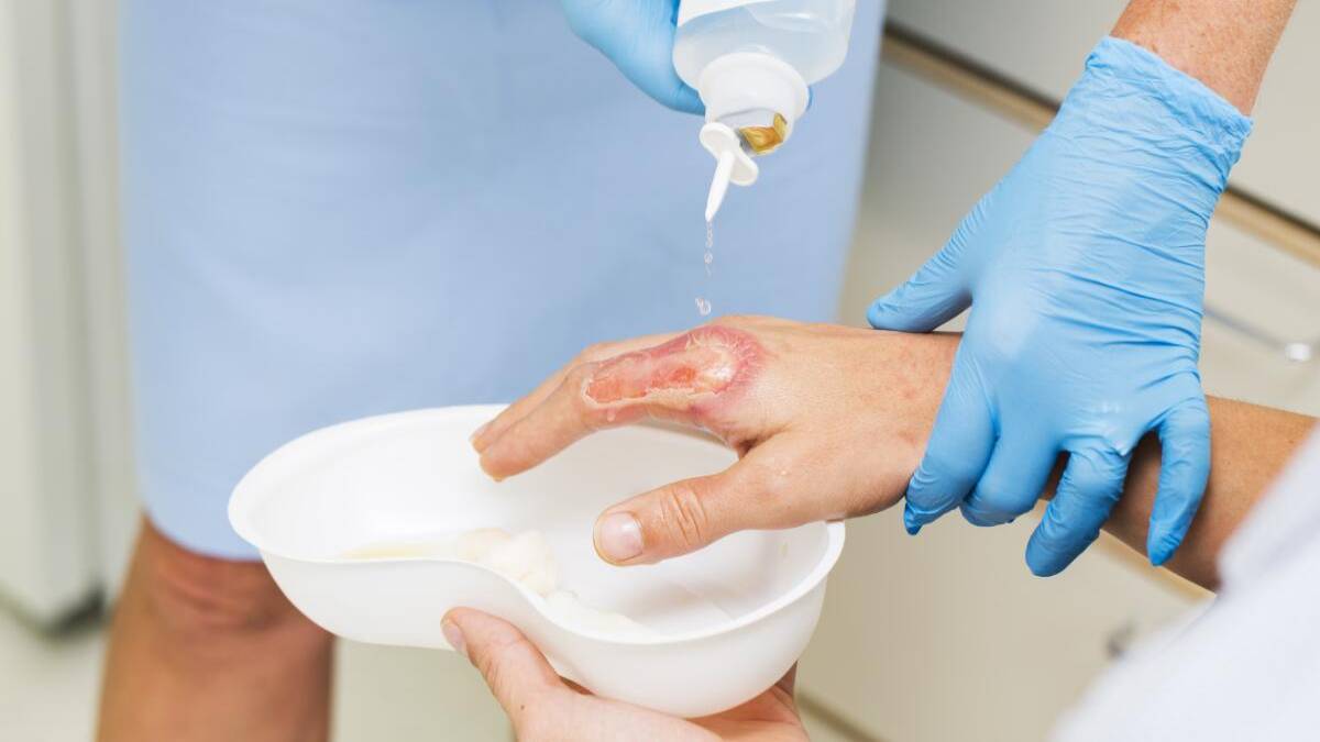 لیست بهترین مراکز درمان زخم در تجریش + هزینه درمان زخم