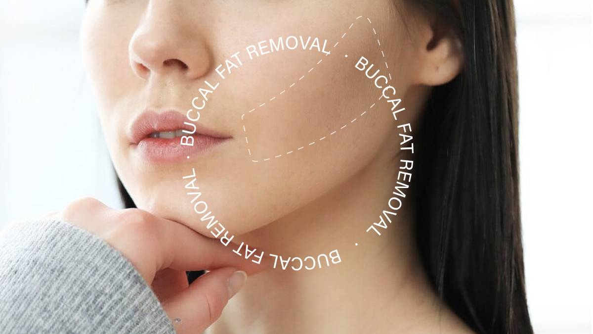لیست بهترین مراکز بوکال فت در فرشته + هزینه بوکال فت