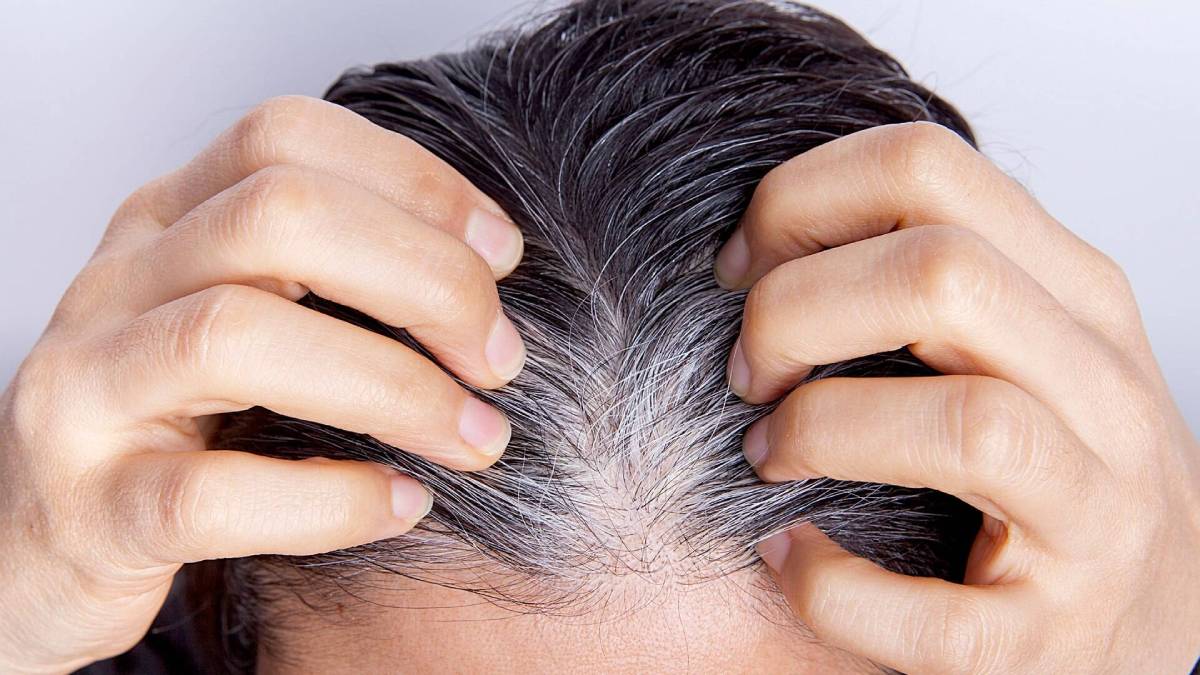 لیست بهترین مراکز رفع سفیدی مو در ولنجک + هزینه رفع سفیدی مو