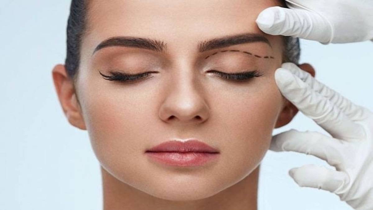 لیست بهترین مراکز لیفت ابرو با نخ در فرشته + هزینه لیفت ابرو با نخ