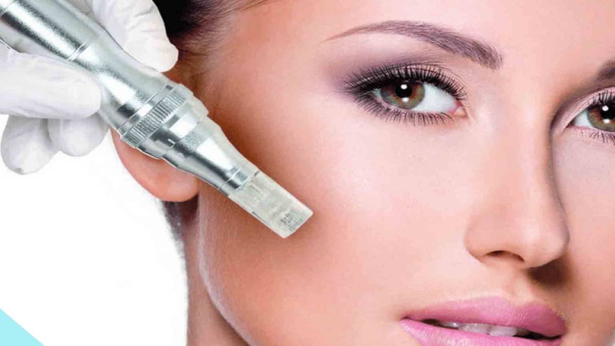 لیست بهترین مراکز مزونیدلینگ در فرشته + هزینه مزونیدلینگ