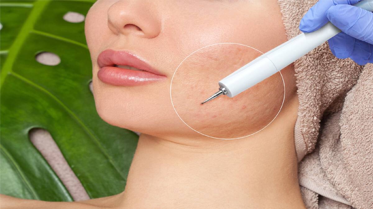 لیست بهترین مراکز سابسیژن در فرشته + هزینه سابسیژن