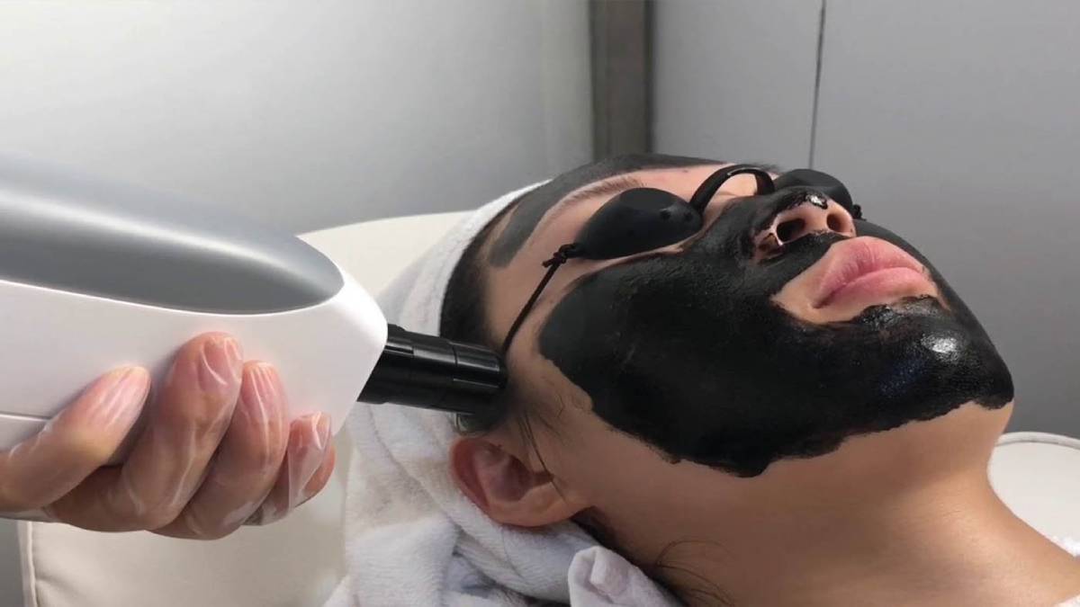 لیست بهترین مراکز پیلینگ کربن در فرشته + هزینه پیلینگ کربن
