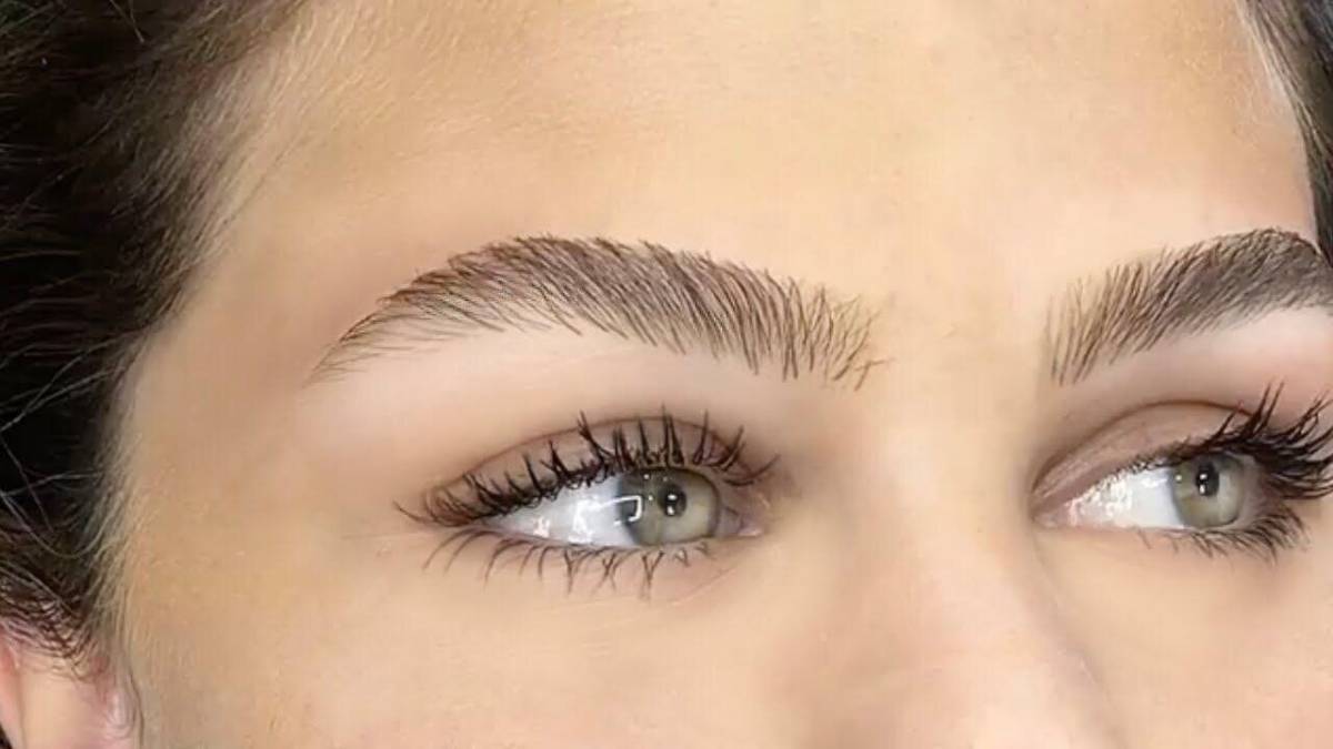 لیست بهترین مراکز لیفت ابرو در ولنجک + هزینه لیفت ابرو