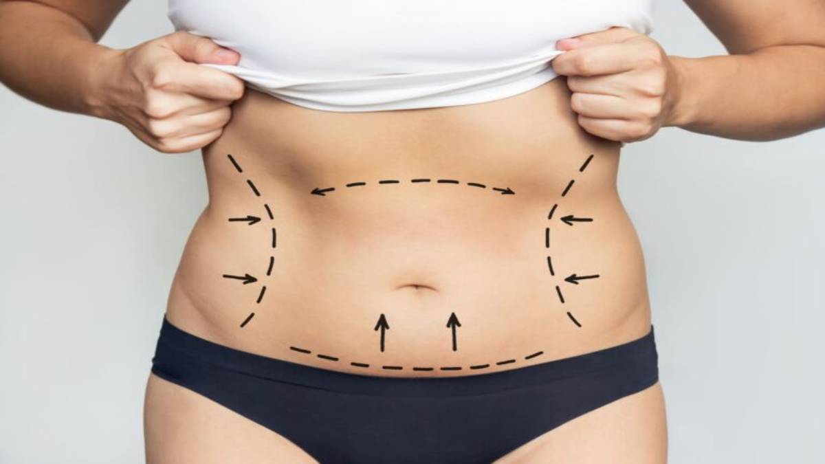 لیست بهترین مراکز پیکرتراشی در فرشته + هزینه پیکرتراشی