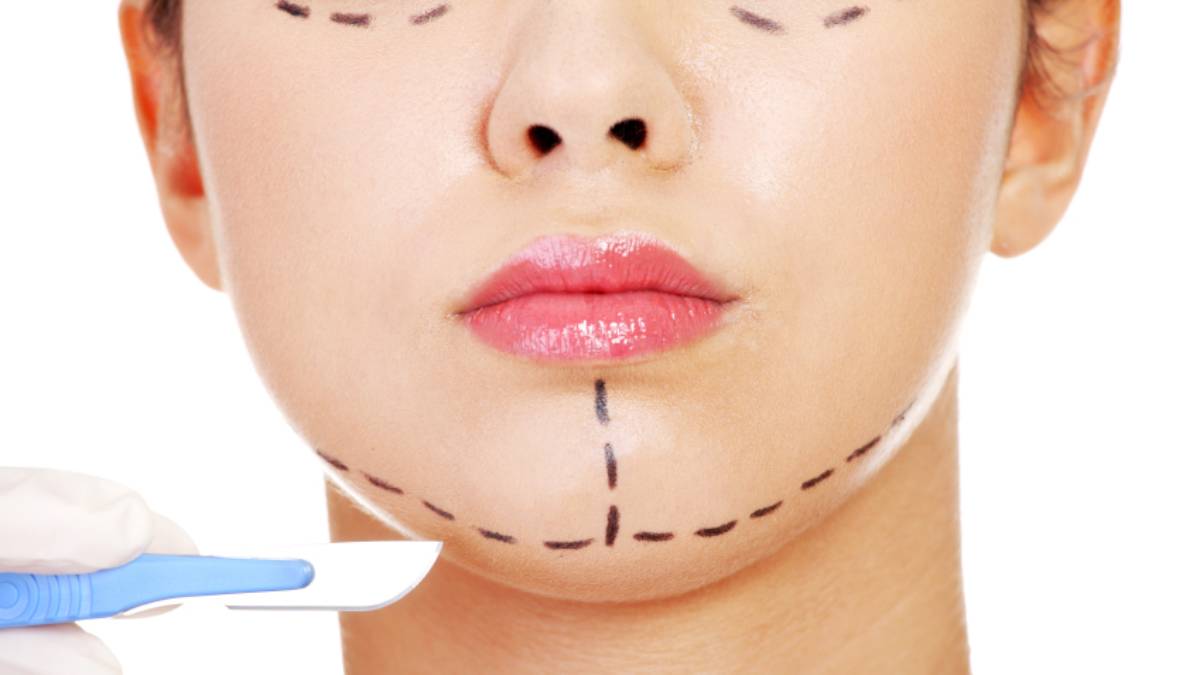 لیست بهترین مراکز جراحی چانه در فرشته + هزینه جراحی چانه