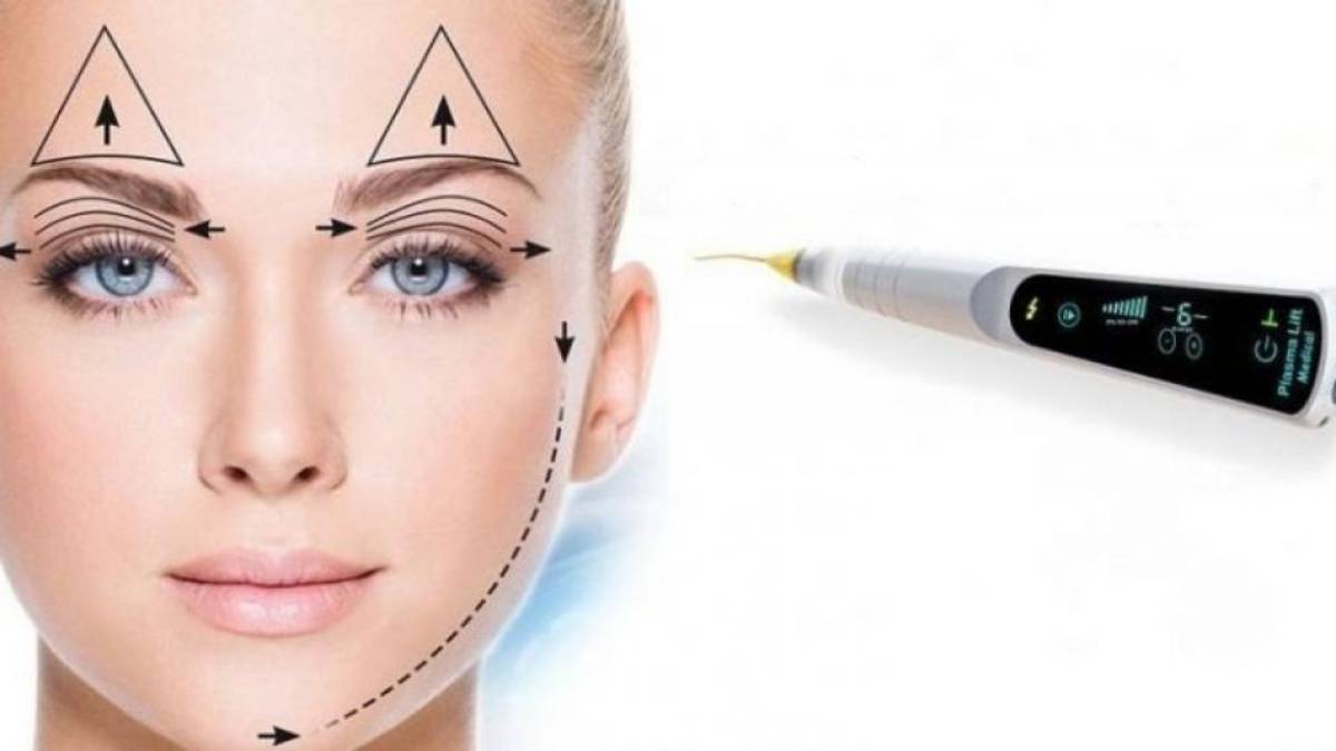 لیست بهترین مراکز پلاسما جت در فرشته + هزینه پلاسما جت
