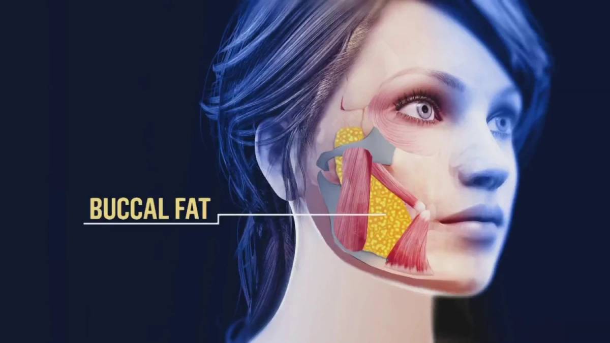 لیست بهترین مراکز بوکال فت در منظریه + هزینه بوکال فت