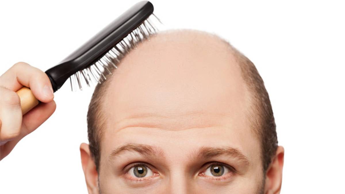 لیست بهترین مراکز درمان ریزش مو در فرشته + هزینه درمان ریزش مو