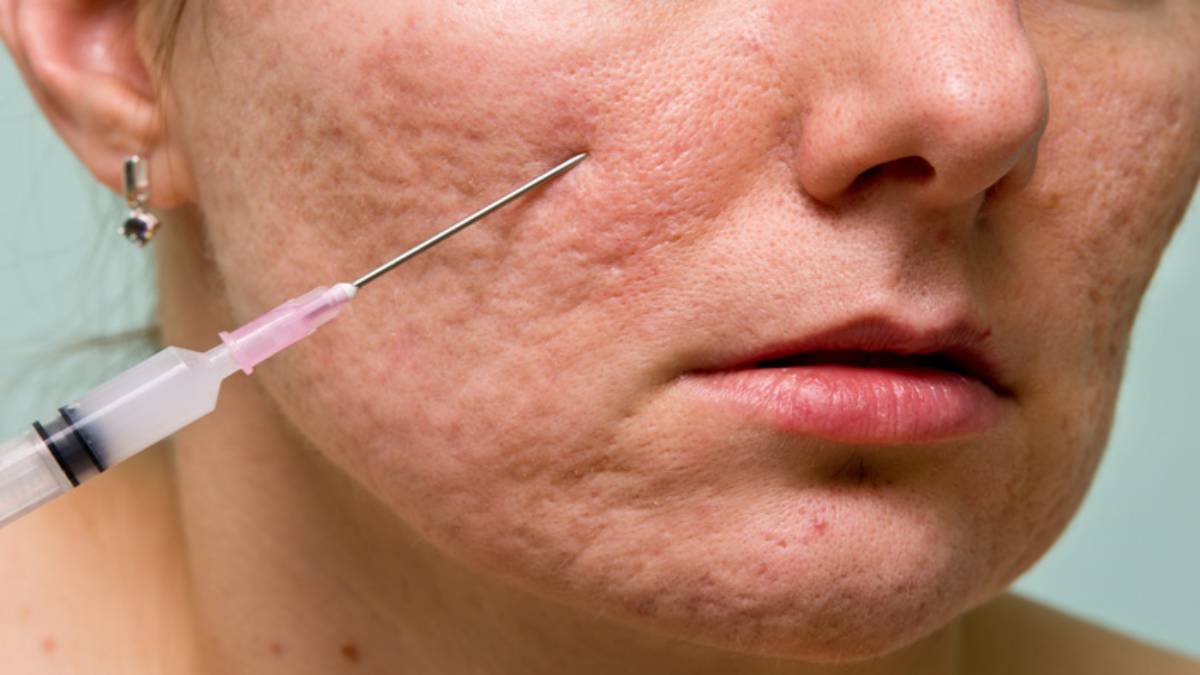 لیست بهترین مراکز سابسیژن در منظریه + هزینه سابسیژن